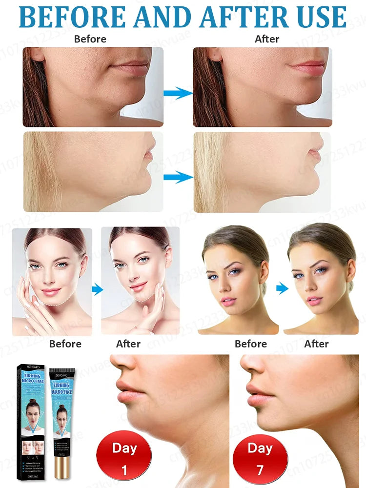 ᴬ ᵖᵃˡᵐ⁻ˢⁱᶻᵉᵈ V-face ɪs ɴᴏᴛ ᴀ ᴅʀᴇᴀᴍ Natural Ingredients 4 Plant Extracts That Naturally Tighten Face & Neck Fat Natural Face Lift.