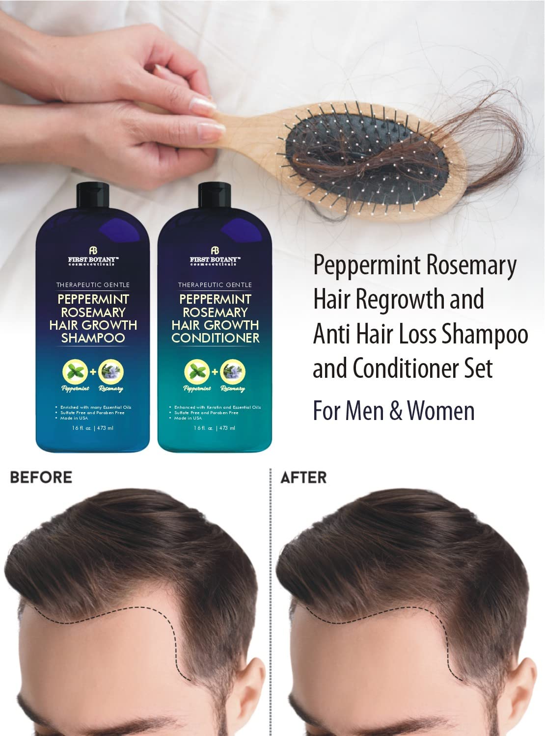 First Botany, Peppermint Rosemary Hair Regrowth and Anti Hair Loss Shampoo and Conditioner Set - Daily Hydrating, Detoxifying, Volumizing Shampoo and Fights Dandruff For Men and Women 16 fl oz x 2