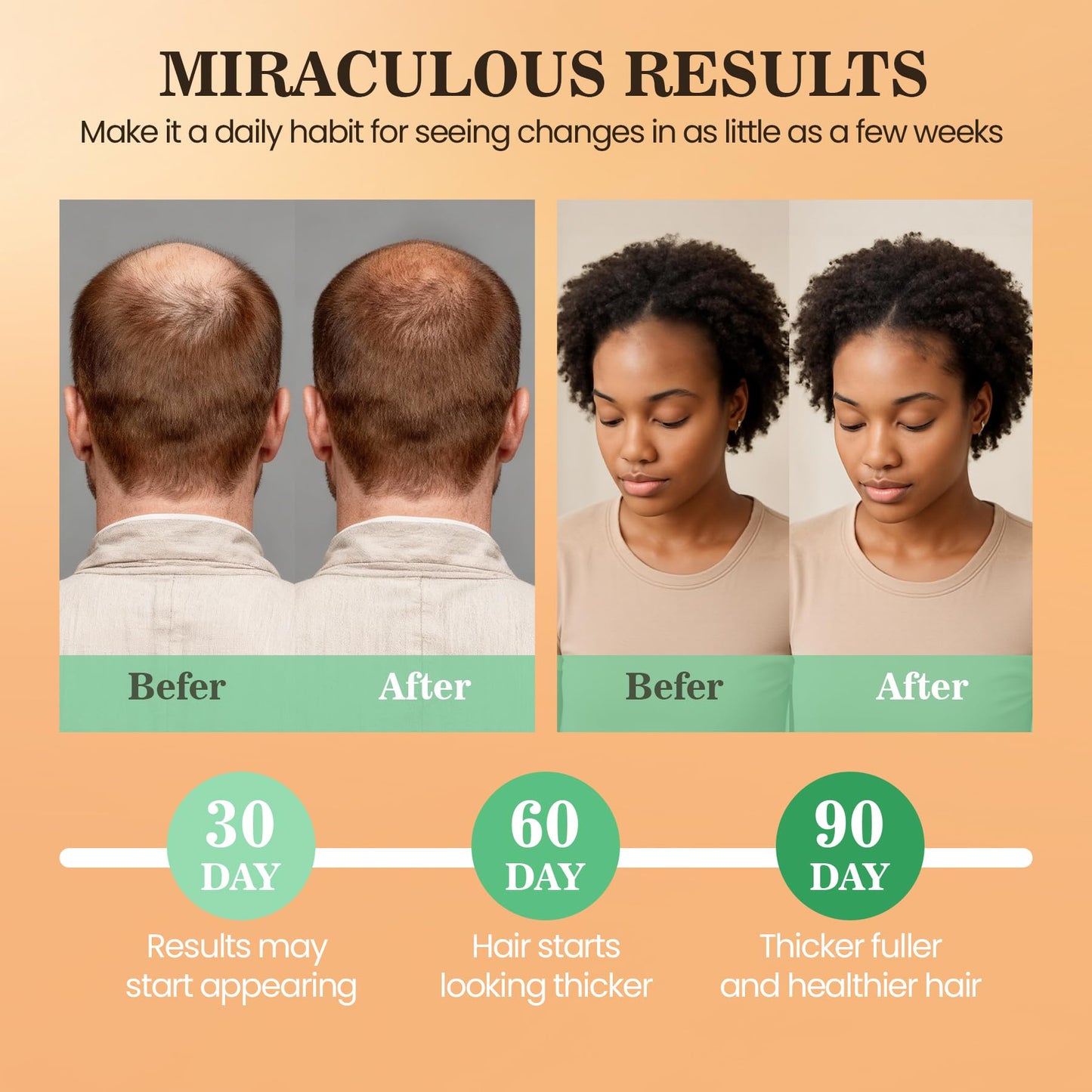 Batana Oil for Hair Growth Dr Sebi, 100% Raw Organic Batana Hair Mask from Honduras, Wild Growth Hair Oil, Scalp Oil Promotes Hair Thickness, Prevents Loss for Men & Women, 4.06 fl oz