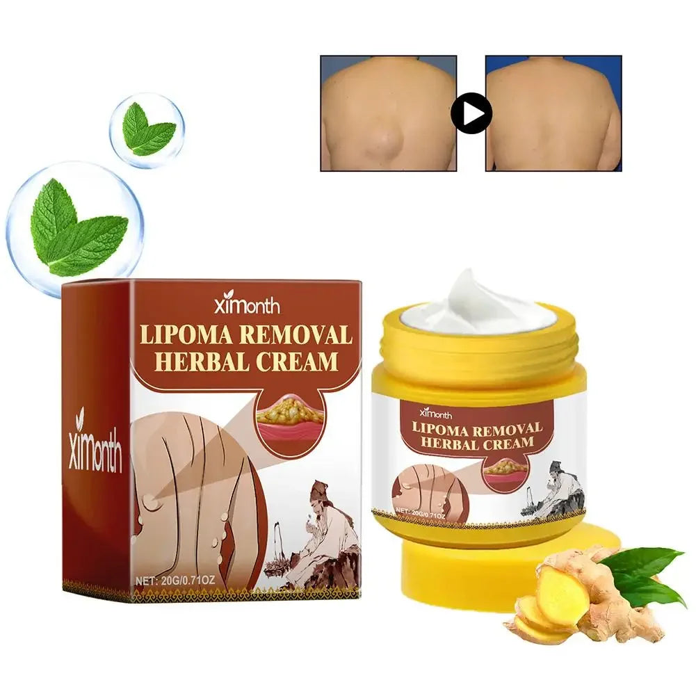 Lipoma Removal Herbal Cream Dissolving Fat  Helps To Tighten Skin.