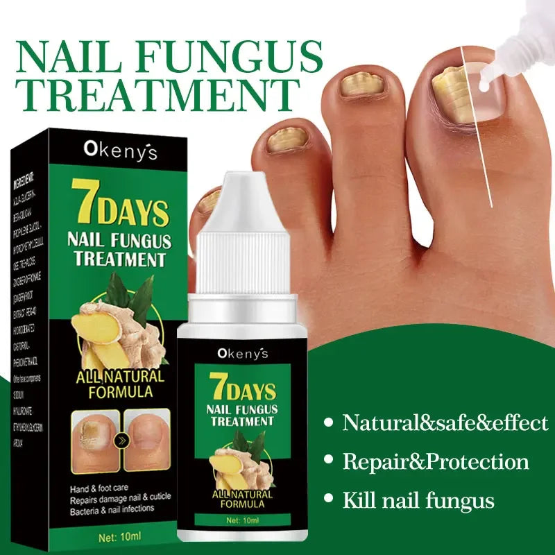 Extra Strong Nail Fungus Treatment Serum Essence oil Feet Nails Repair Care Essence Cream Anti Infection Toe Fungal Removal