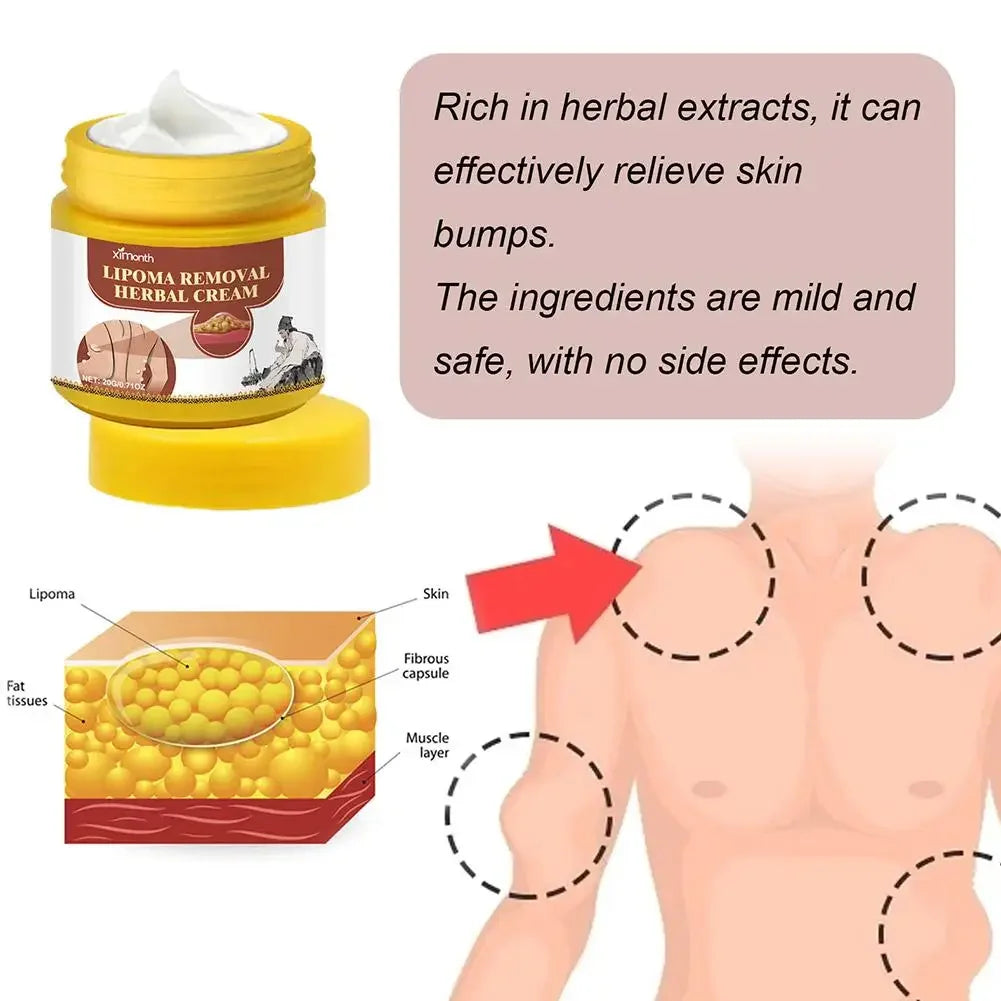 Lipoma Removal Herbal Cream Dissolving Fat  Helps To Tighten Skin.