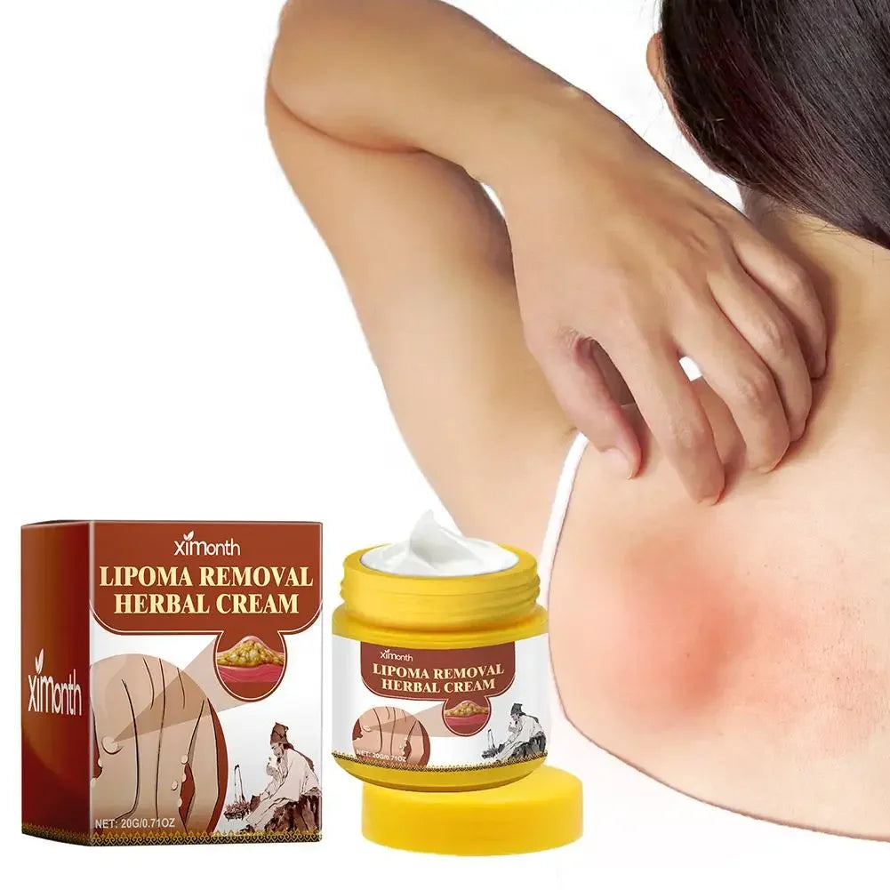 Lipoma Removal Herbal Cream Dissolving Fat  Helps To Tighten Skin.