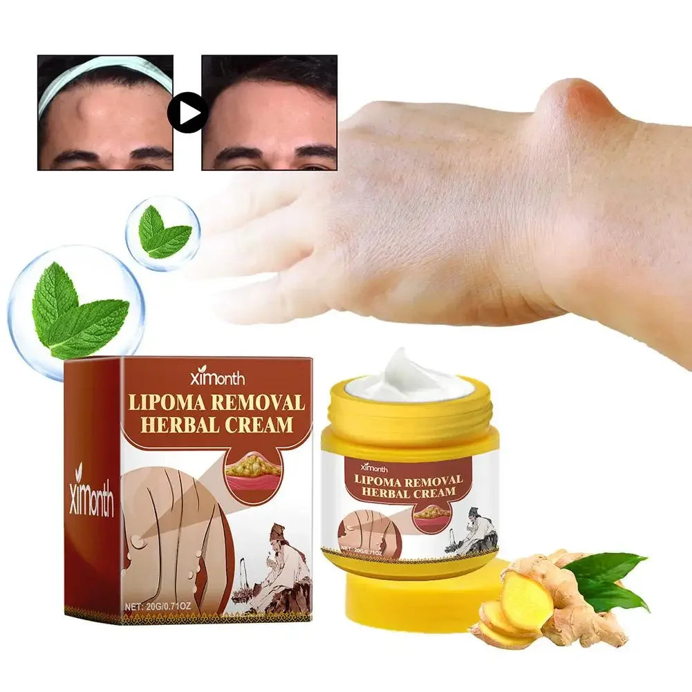 Lipoma Removal Herbal Cream Dissolving Fat  Helps To Tighten Skin.